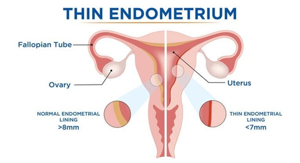اندومتر | Endometrium