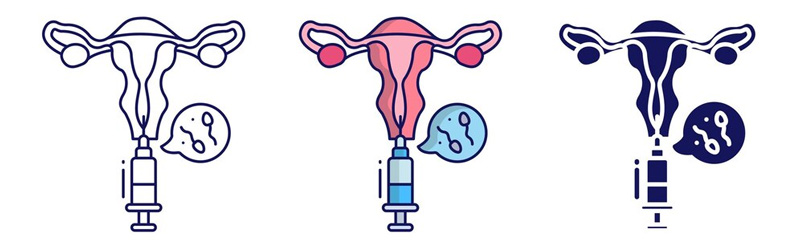 آی یو آی | درمان ناباروری | IUI | IVF | اسپرم | رحم
