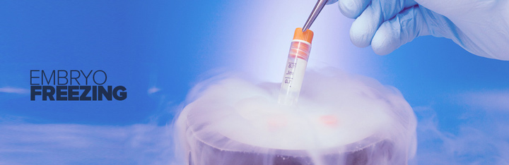 فریز جنین حاصل از آی وی اف IVF | انجماد جنین | Embryo Freezing